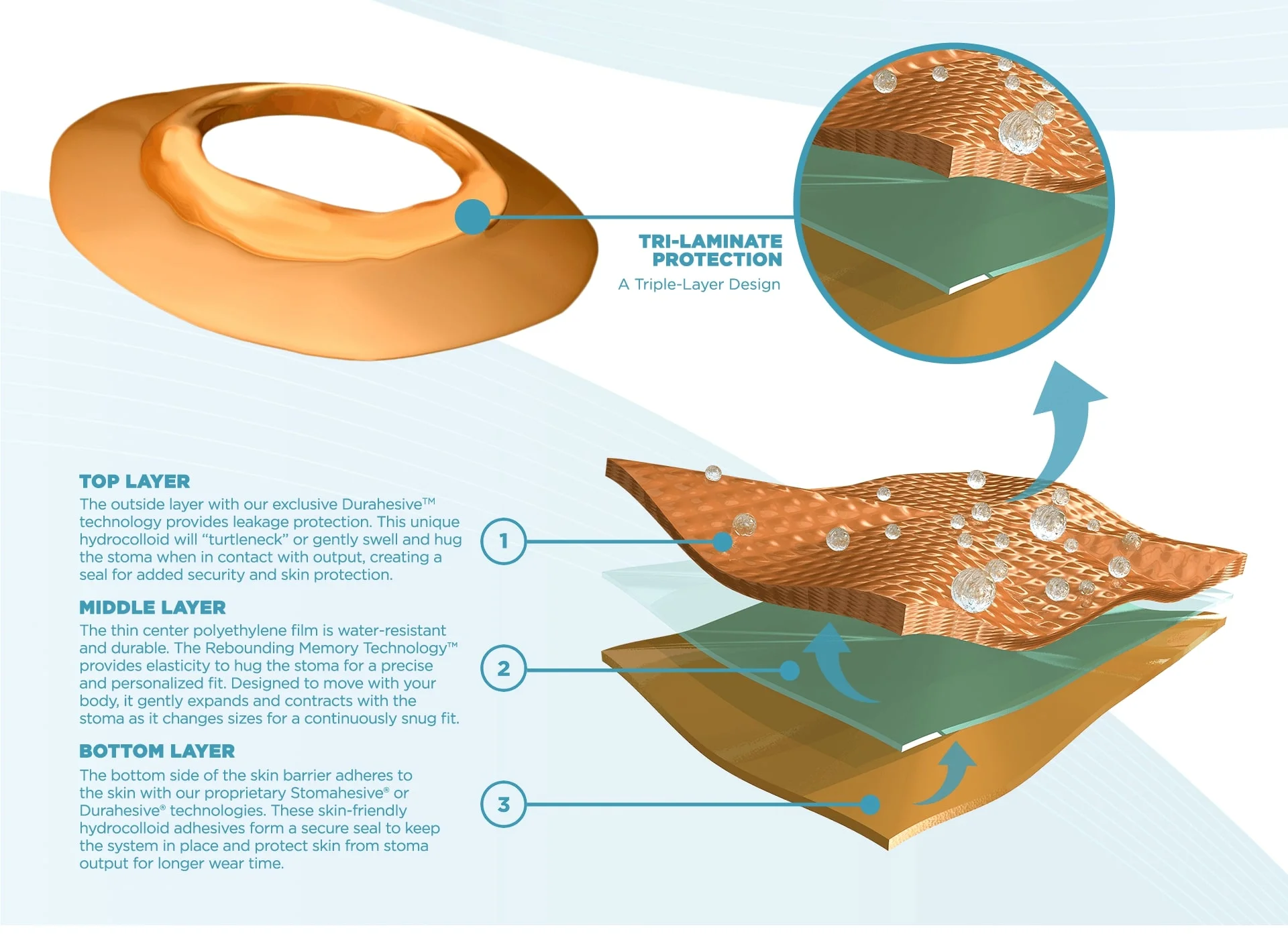 Tri-Laminate 보호의 그림