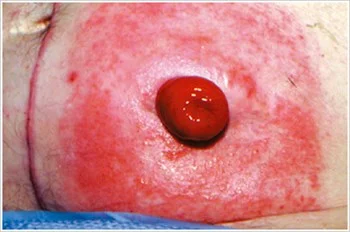 eine Nahaufnahme des Mundes einer Person