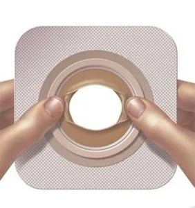 Convatec Moldable Technology™ Skin Barriers